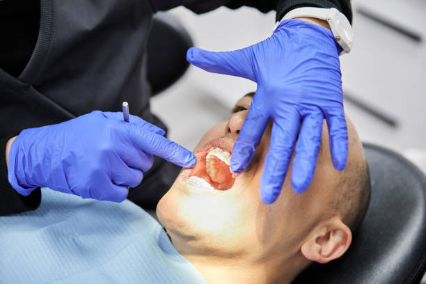 Best Emergency Wisdom Teeth Removal in Duncanville, TX